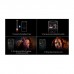Стайлер Dyson Airwrap I.D. HS08 T3/T4 Curly+Coily Red Velvet/Gold (596928-01)